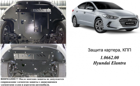 Защита двигателя КОЛЬЧУГА для Hyundai Elantra VI (AD) (2016-) 1,6GDI и 2,0 АКПП