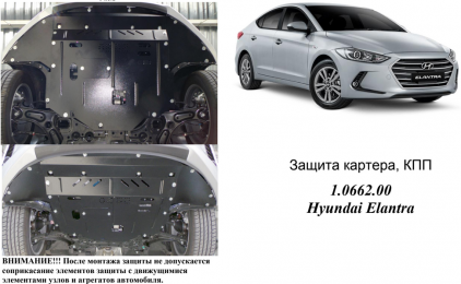Захист двигуна КОЛЬЧУГА для Hyundai Elantra VI (AD) (2016-) 1,6 GDI і 2,0 АКПП